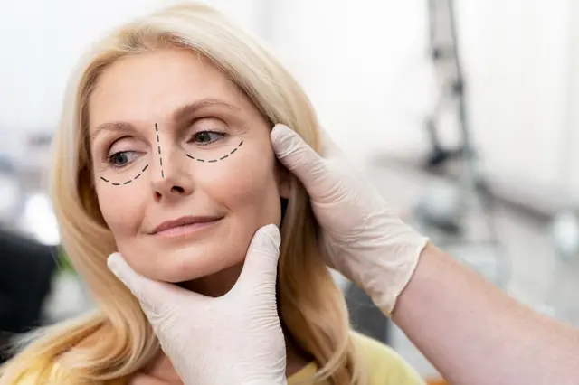 blefaroplastie
