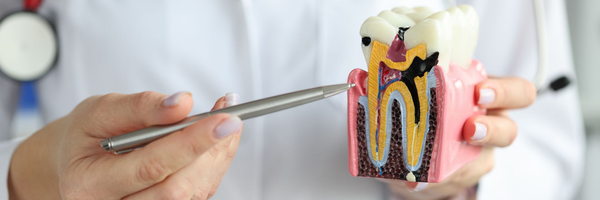 implant